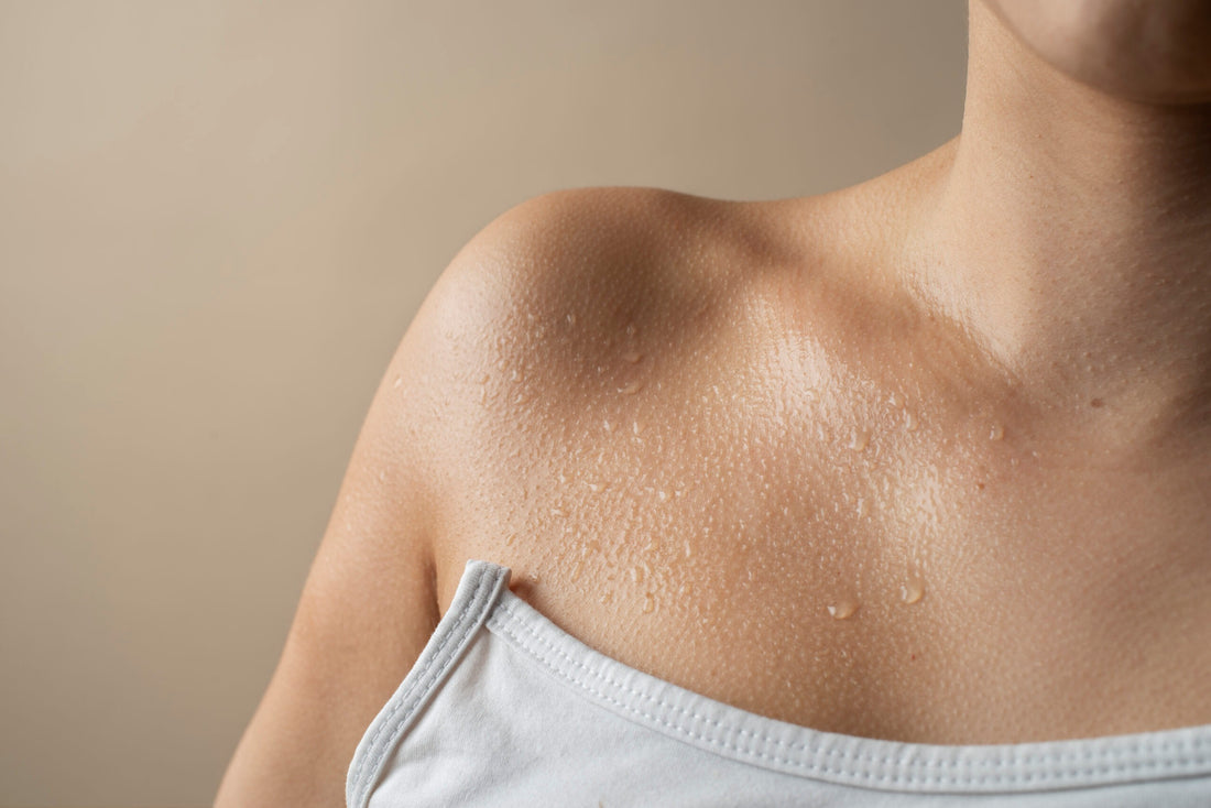 Alergia al sudor: ¿Cuáles son los síntomas y cómo tratarla?