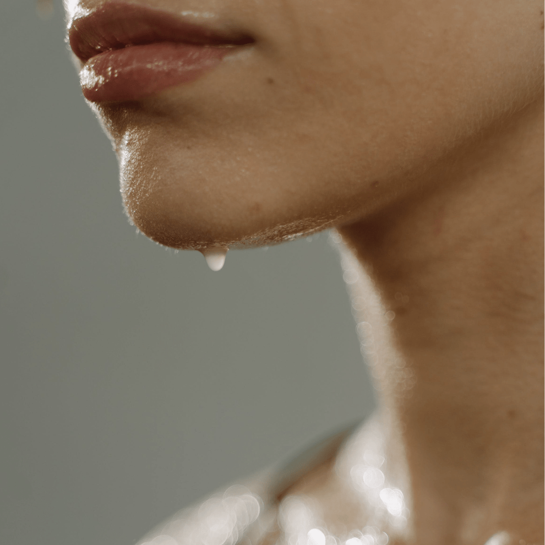Hiperhidrosis: más allá de la sudoración excesiva