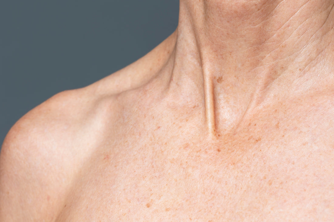 Dermatitis atópica y seborreica: diferencias clave para no confundirlas ni tratarlas igual