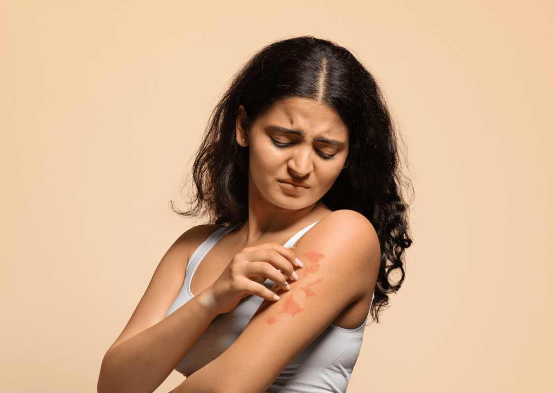 Piel Sensible y Dermatitis Atópica: Descubre el papel clave de la regulación del Sistema Nervioso en el picor