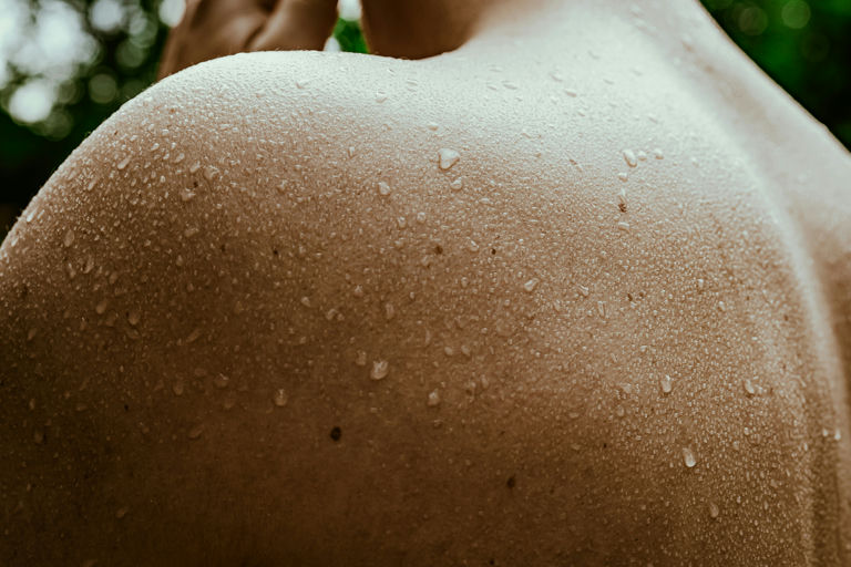 El papel del sistema nervioso cutáneo en la hiperhidrosis: de la fisiopatología a nuevas soluciones