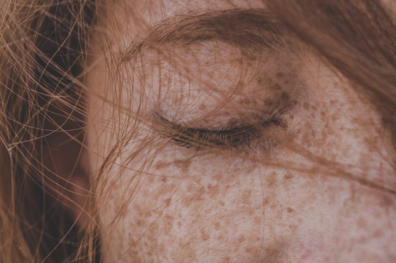 ¿Cómo se protege la piel de la radiación ultravioleta?